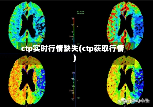 ctp实时行情缺失(ctp获取行情)-第2张图片